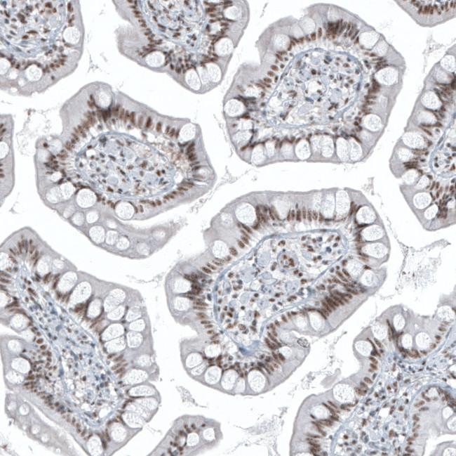 SP100 Antibody in Immunohistochemistry (IHC)