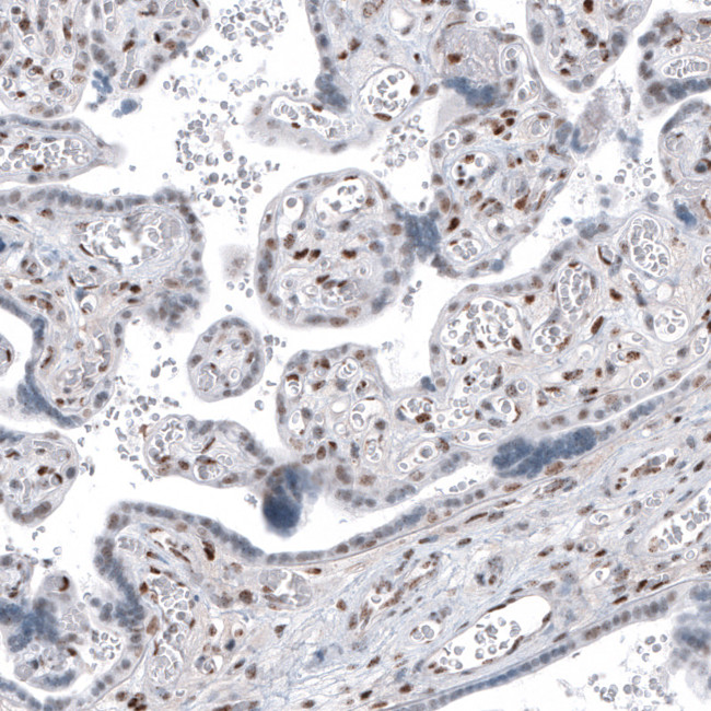 SP100 Antibody in Immunohistochemistry (IHC)