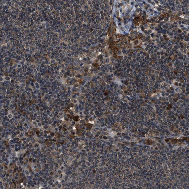 SLC15A4 Antibody in Immunohistochemistry (IHC)