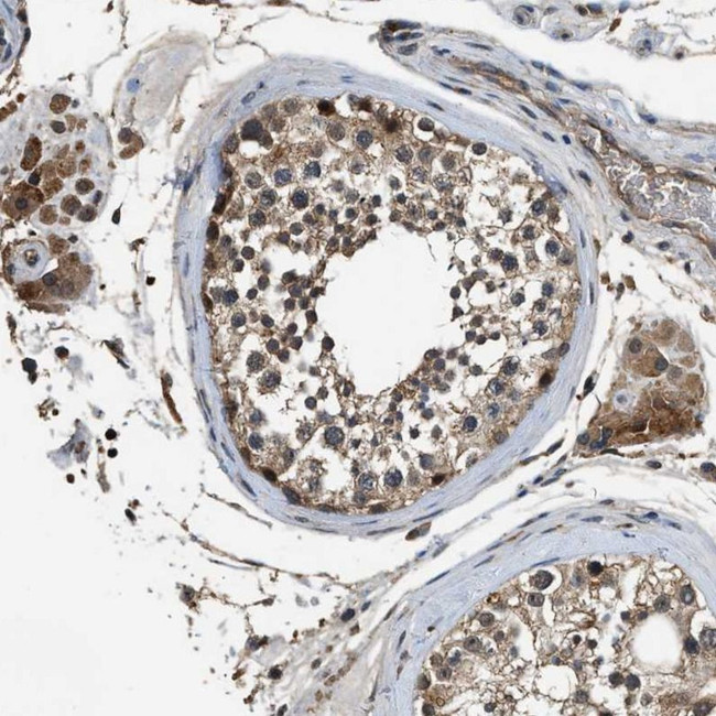 SLC15A4 Antibody in Immunohistochemistry (IHC)