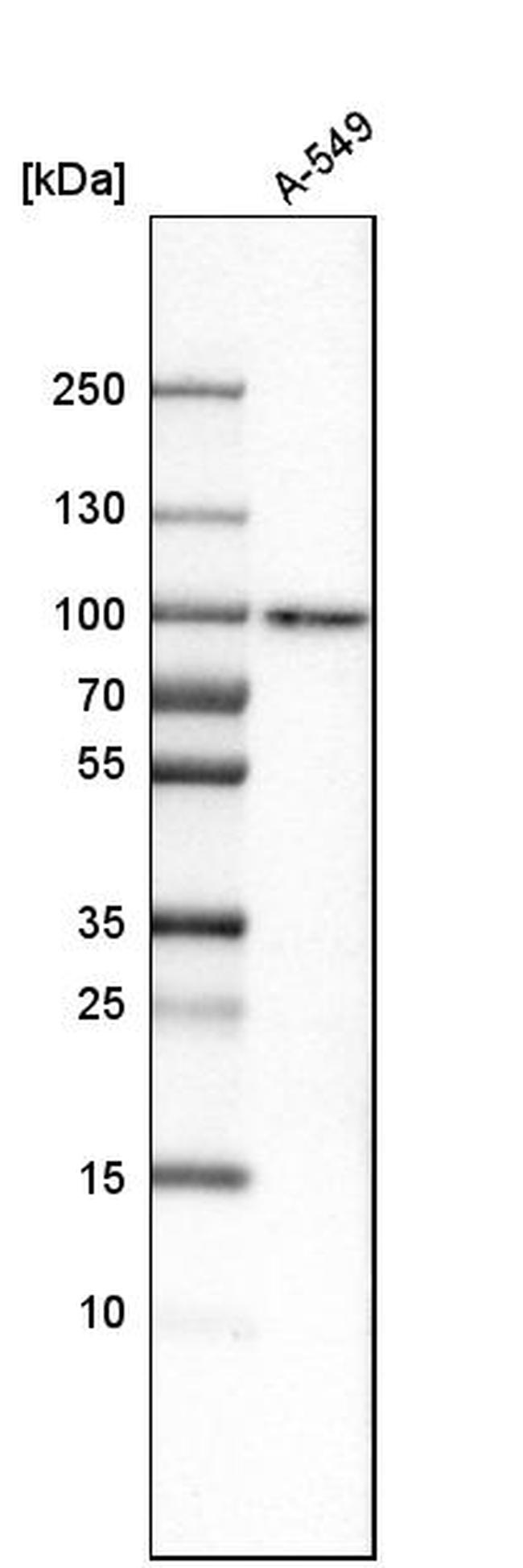 SAMD4B Antibody in Western Blot (WB)