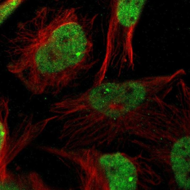 ZBTB20 Antibody in Immunocytochemistry (ICC/IF)