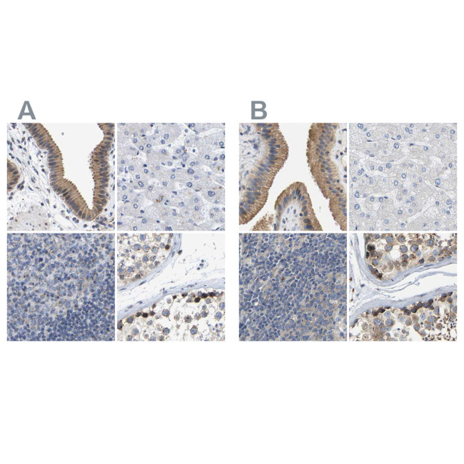 Pericentrin Antibody in Immunohistochemistry (IHC)