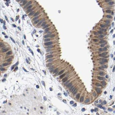 Pericentrin Antibody in Immunohistochemistry (IHC)