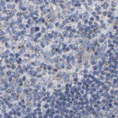 Pericentrin Antibody in Immunohistochemistry (IHC)