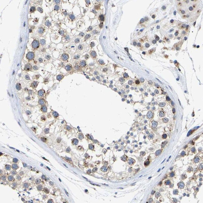 Pericentrin Antibody in Immunohistochemistry (IHC)