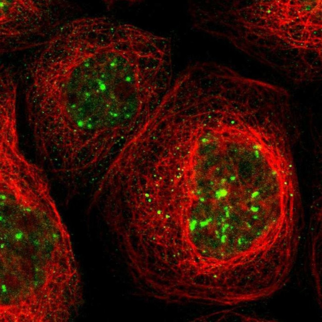 PTPN23 Antibody in Immunocytochemistry (ICC/IF)