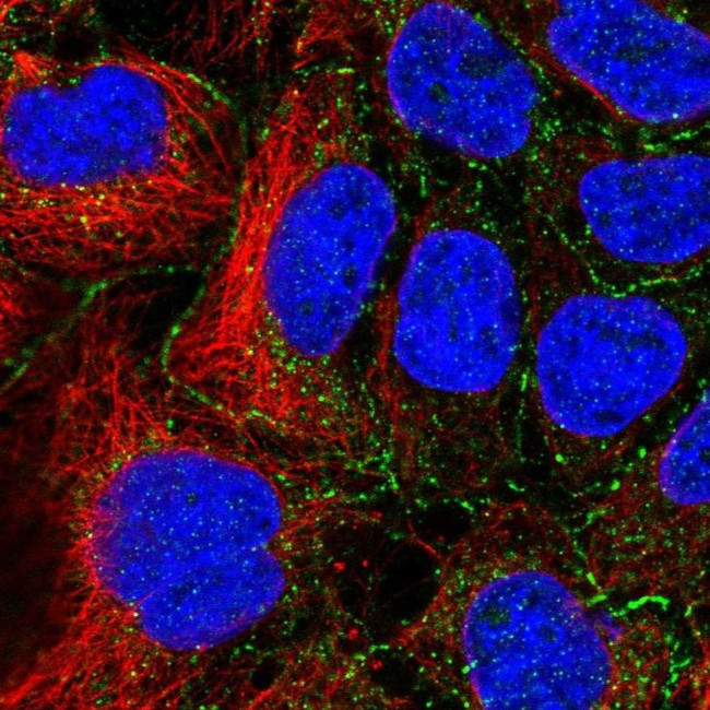 SLC16A10 Antibody in Immunocytochemistry (ICC/IF)