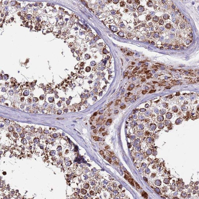 ZBTB39 Antibody in Immunohistochemistry (IHC)