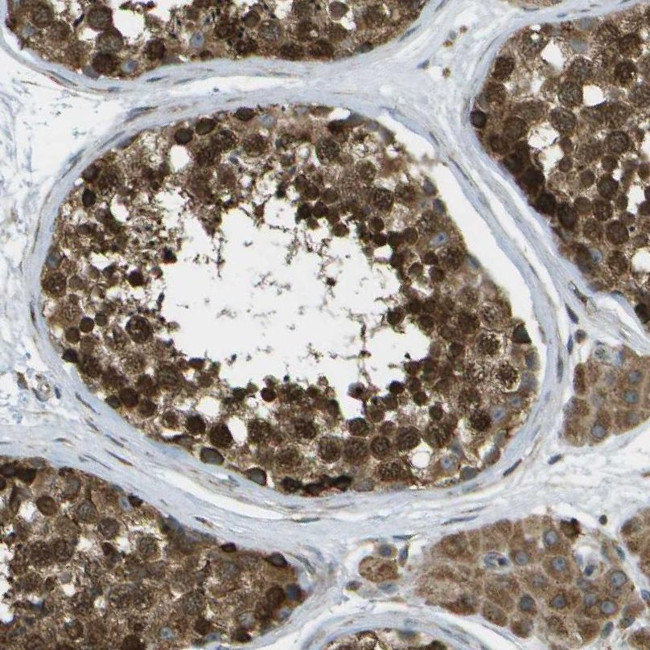 USP30 Antibody in Immunohistochemistry (IHC)