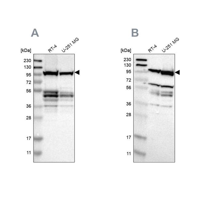 DAP5 Antibody in Western Blot (WB)