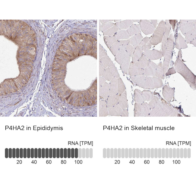 P4HA2 Antibody in Immunohistochemistry (IHC)