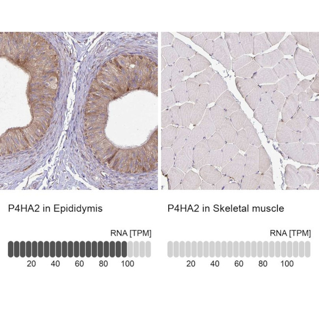 P4HA2 Antibody