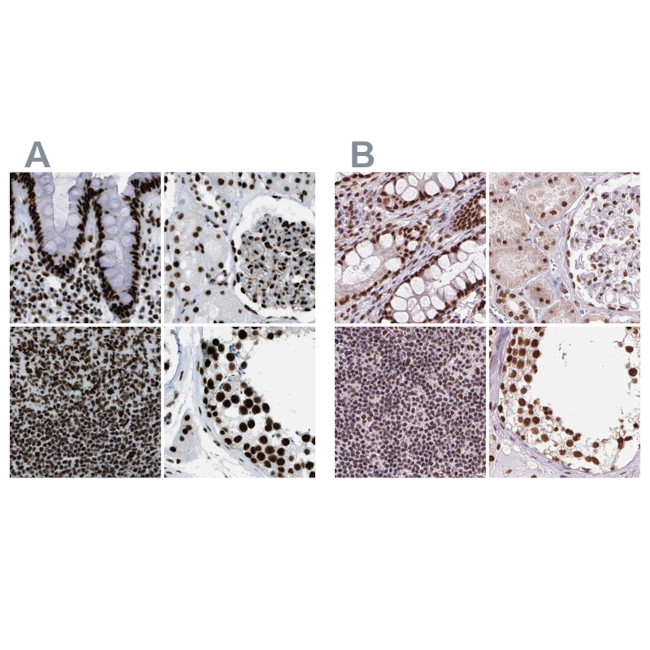 ZNF207 Antibody in Immunohistochemistry (IHC)