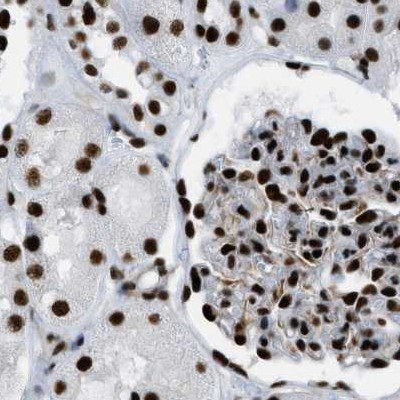 ZNF207 Antibody in Immunohistochemistry (IHC)