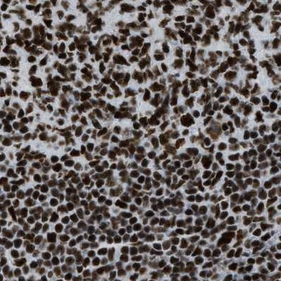 ZNF207 Antibody in Immunohistochemistry (IHC)