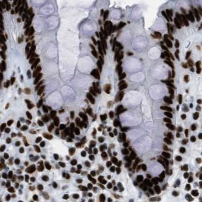 ZNF207 Antibody in Immunohistochemistry (IHC)