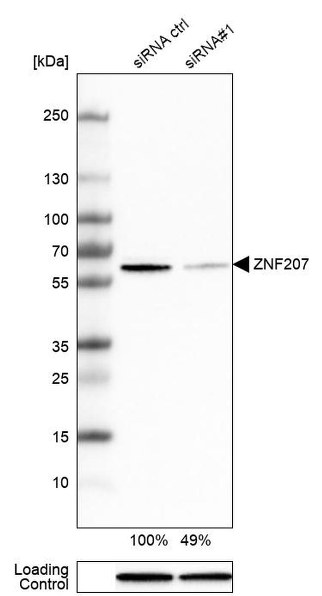 ZNF207 Antibody in Western Blot (WB)