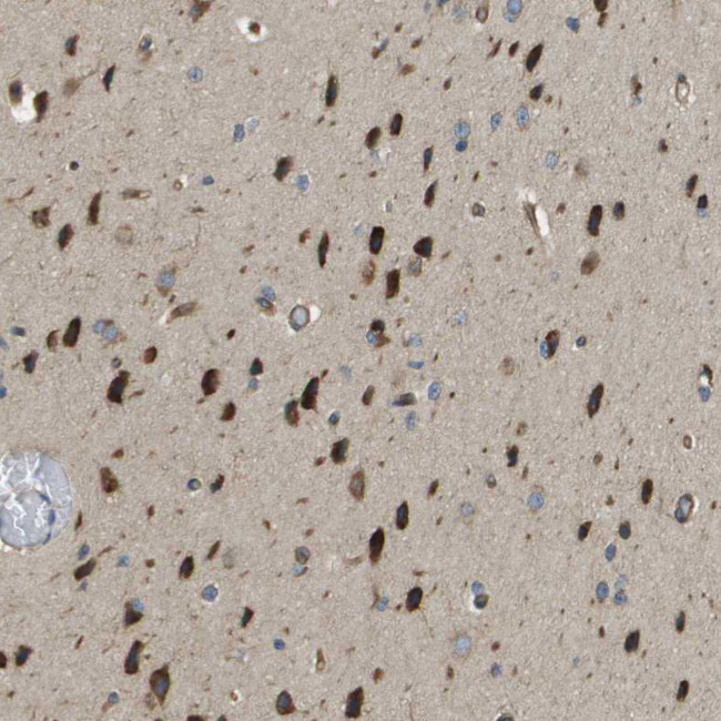 DNAJB11 Antibody in Immunohistochemistry (IHC)