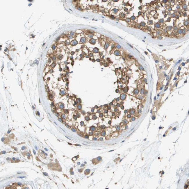 DNAJB11 Antibody in Immunohistochemistry (IHC)