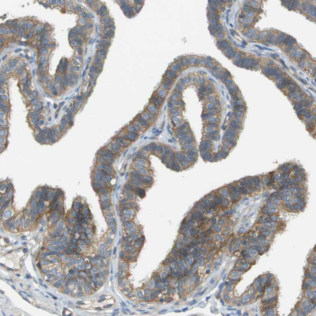 DNAJB11 Antibody in Immunohistochemistry (IHC)