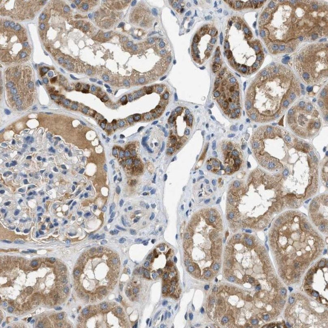 PNKD Antibody in Immunohistochemistry (IHC)