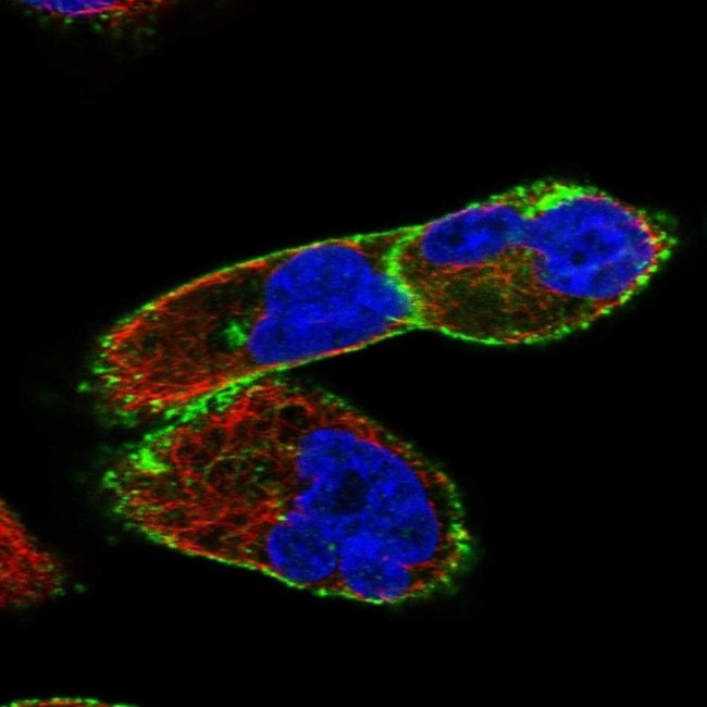 Dysferlin Antibody in Immunocytochemistry (ICC/IF)