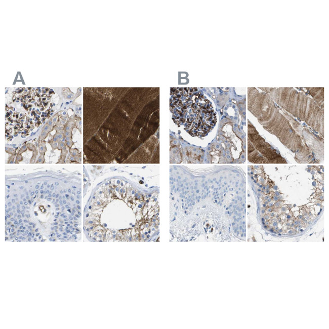 Dysferlin Antibody in Immunohistochemistry (IHC)