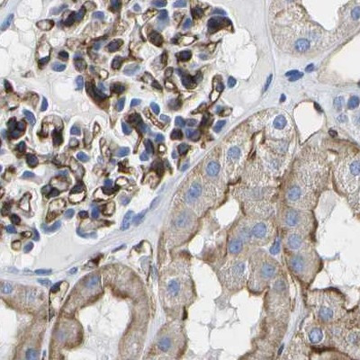 Dysferlin Antibody in Immunohistochemistry (IHC)