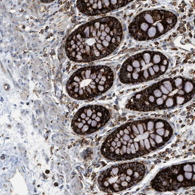 SQRDL Antibody in Immunohistochemistry (IHC)