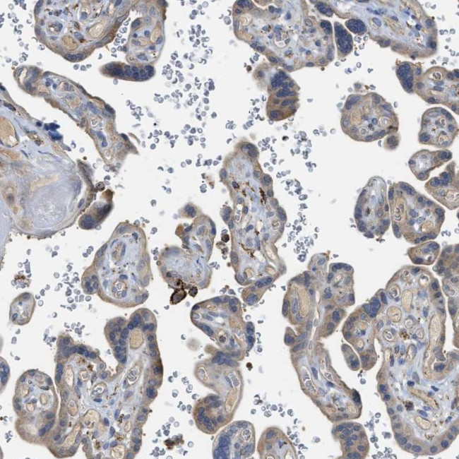 SQRDL Antibody in Immunohistochemistry (IHC)