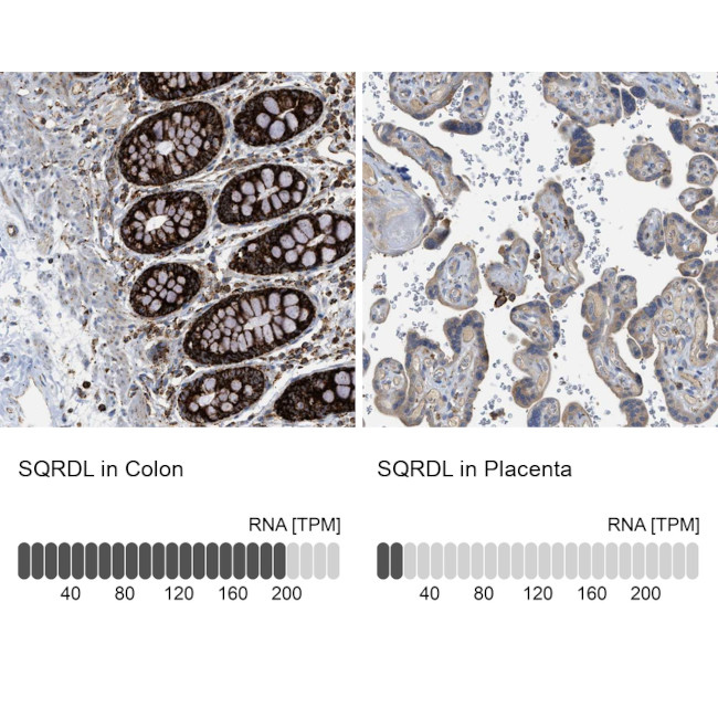 SQRDL Antibody