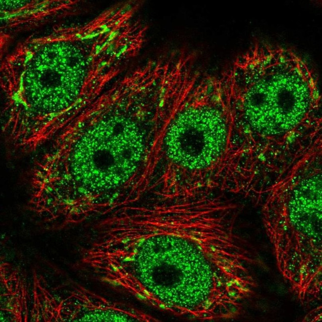 GALNT6 Antibody in Immunocytochemistry (ICC/IF)