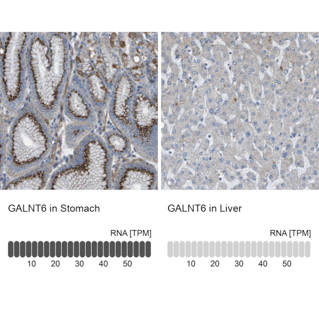 GALNT6 Antibody in Immunohistochemistry (IHC)