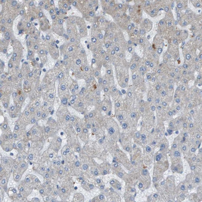 GALNT6 Antibody in Immunohistochemistry (IHC)