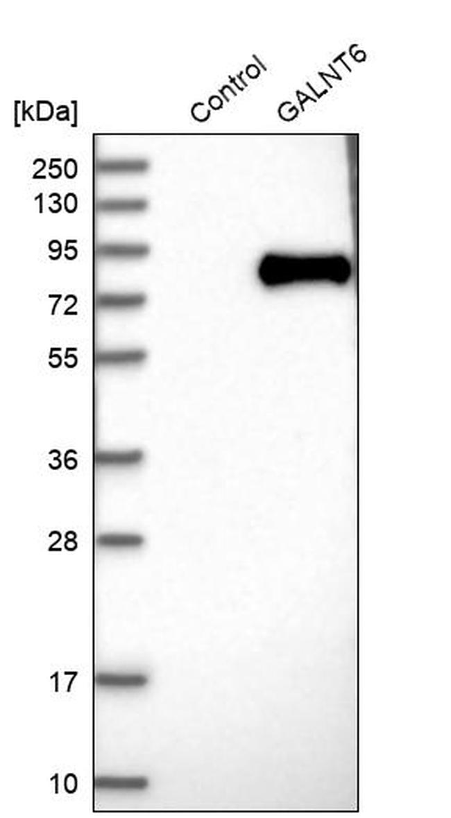 GALNT6 Antibody in Western Blot (WB)