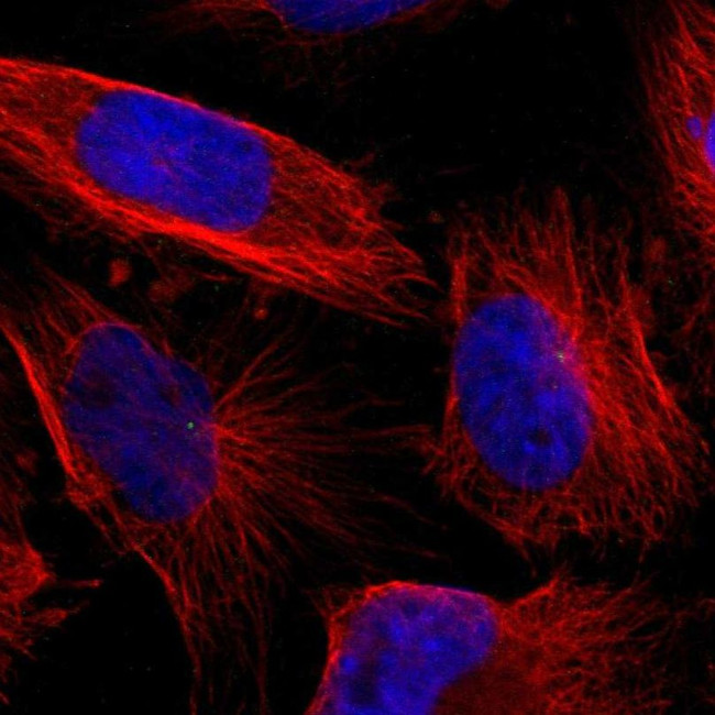 LGI2 Antibody in Immunocytochemistry (ICC/IF)