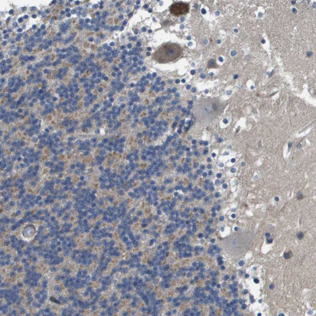 SCN4B Antibody in Immunohistochemistry (IHC)