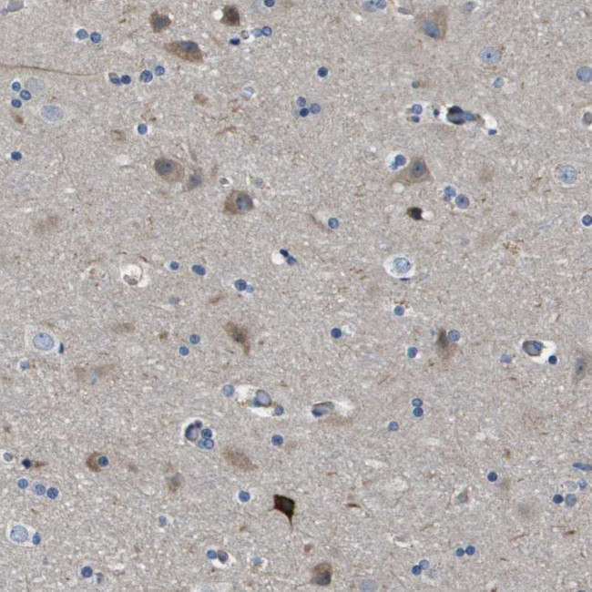 SCN4B Antibody in Immunohistochemistry (IHC)