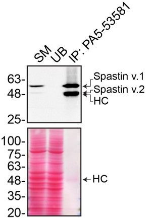 Spastin Antibody in Immunoprecipitation (IP)