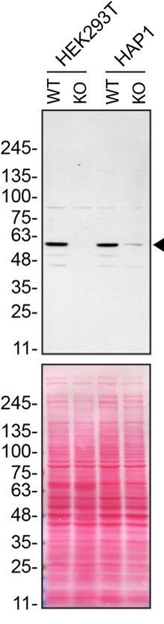 Spastin Antibody in Western Blot (WB)