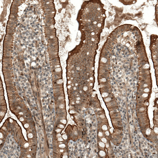 IFNLR1 Antibody in Immunohistochemistry (IHC)