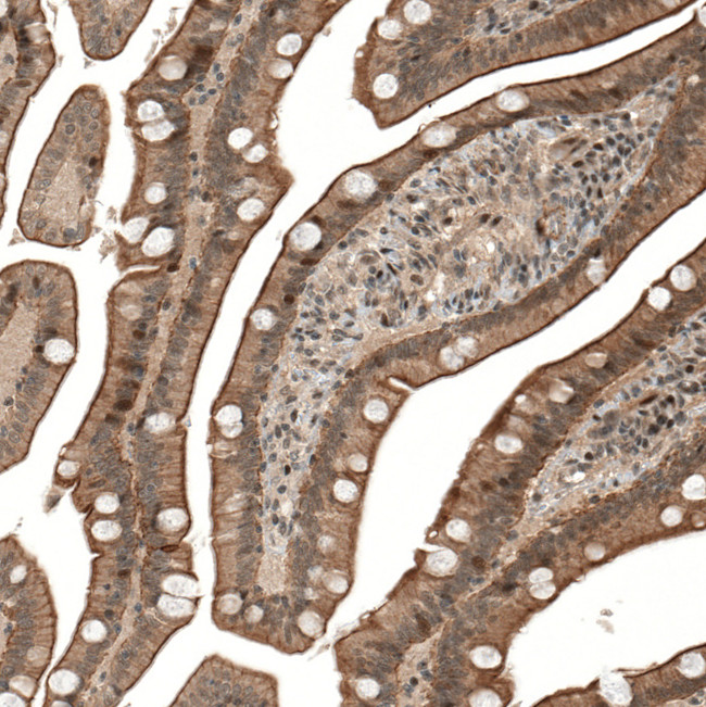 IFNLR1 Antibody in Immunohistochemistry (IHC)