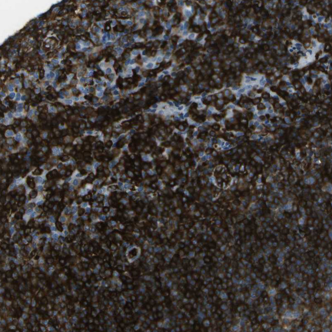 ABI3 Antibody in Immunohistochemistry (IHC)