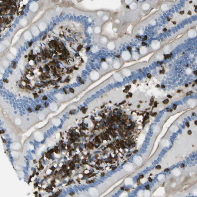 ABI3 Antibody in Immunohistochemistry (IHC)