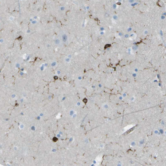 ABI3 Antibody in Immunohistochemistry (IHC)