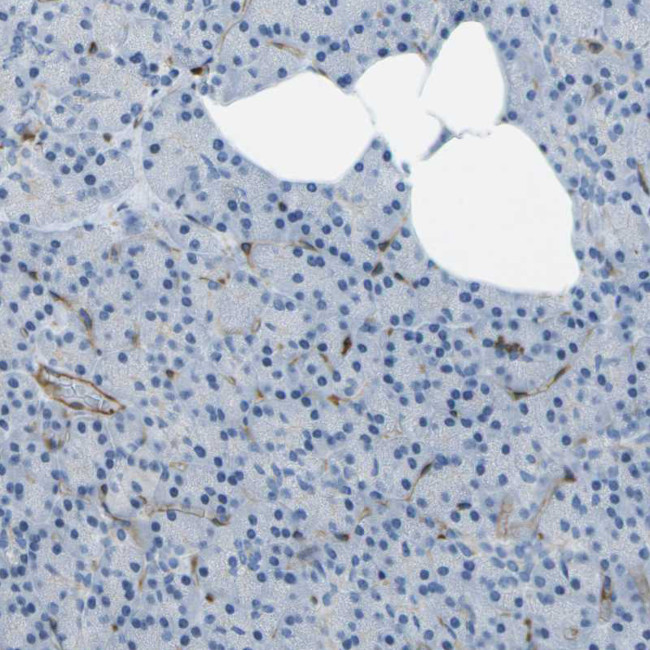 ABI3 Antibody in Immunohistochemistry (IHC)