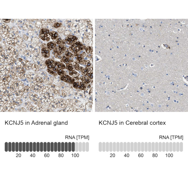 Kir3.4 (KCNJ5) Antibody