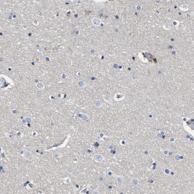 Kir3.4 (KCNJ5) Antibody in Immunohistochemistry (IHC)