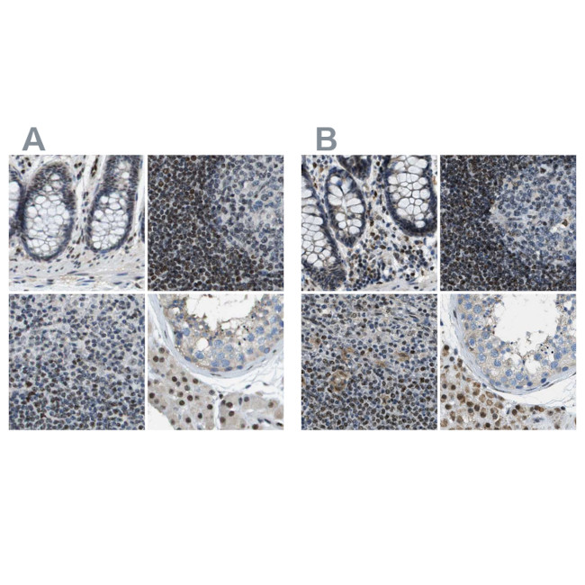 SP100 Antibody in Immunohistochemistry (IHC)